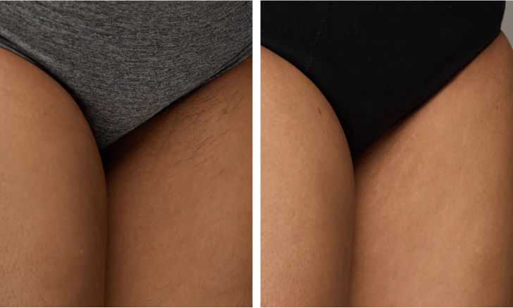 Smooth, irritation-free results