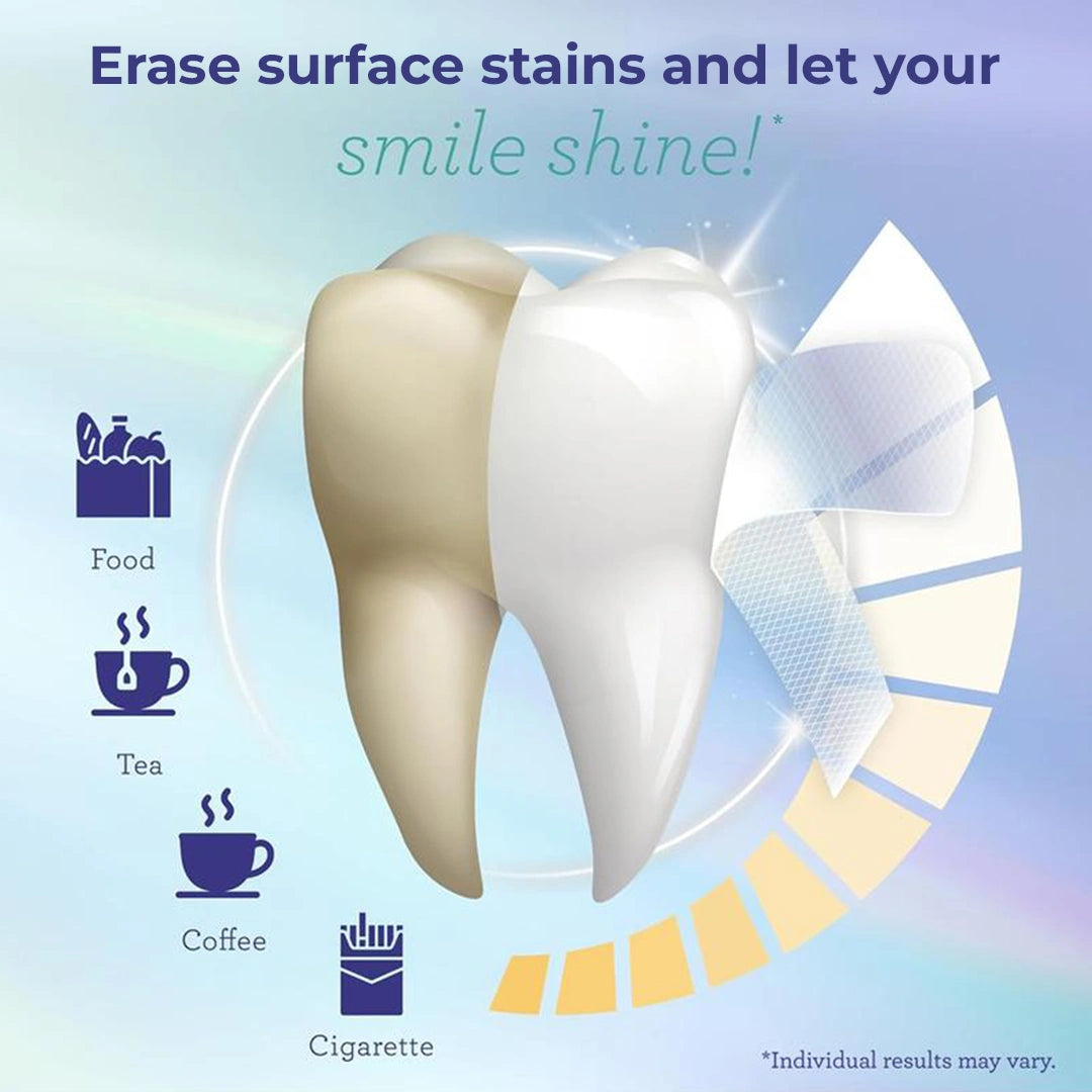 7-Day Whitening Strips