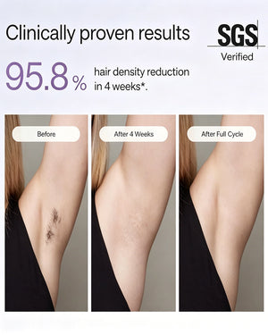IPL Laser Hair Removal Device