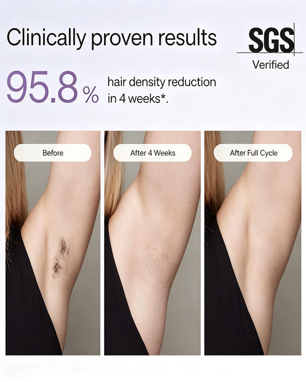 IPL Laser Hair Removal Device